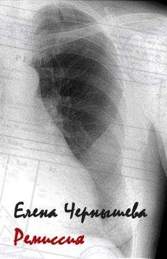 Елена Чернышева - Ремиссия - Читать 📖 Читать онлайн 👀 Читаемые книги читать онлайн бесплатно 🔥 booksread-online.com