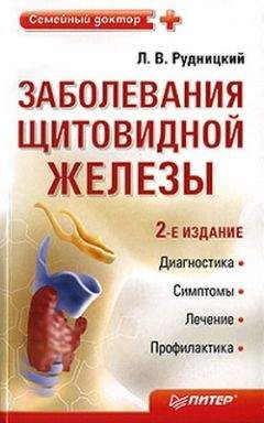 Леонид Рудницкий - Заболевания щитовидной железы: лечение и профилактика - Читать 📖 Читать онлайн 👀 Читаемые книги читать онлайн бесплатно 🔥 booksread-online.com