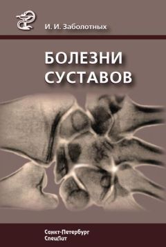 Инга Заболотных - Болезни суставов - Читать 📖 Читать онлайн 👀 Читаемые книги читать онлайн бесплатно 🔥 booksread-online.com