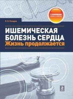 Елена Киладзе - Ишемическая болезнь сердца. Жизнь продолжается - Читать 📖 Читать онлайн 👀 Читаемые книги читать онлайн бесплатно 🔥 booksread-online.com