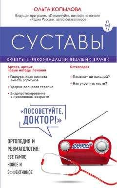 Ольга Копылова - Суставы. Советы и рекомендации ведущих врачей - Читать 📖 Читать онлайн 👀 Читаемые книги читать онлайн бесплатно 🔥 booksread-online.com