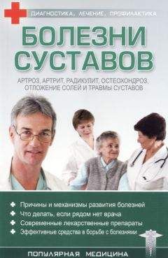 С. Трофимов (ред.) - Болезни суставов - Читать 📖 Читать онлайн 👀 Читаемые книги читать онлайн бесплатно 🔥 booksread-online.com