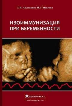 Эдуард Айламазян - Изоиммунизация при беременности - Читать | Читать онлайн | Читаемые книги читать онлайн бесплатно | booksread-online.com