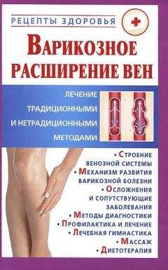 Виктор Горбунов - Варикозное расширение вен. Лечение традиционными и нетрадиционными методами - Читать 📖 Читать онлайн 👀 Читаемые книги читать онлайн бесплатно 🔥 booksread-online.com