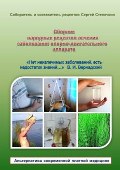 Сергей Степочкин - Сборник народных рецептов лечения заболеваний опорно-двигательного аппарата - Читать 📖 Читать онлайн 👀 Читаемые книги читать онлайн бесплатно 🔥 booksread-online.com