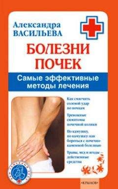 Александра Васильева - Болезни почек. Самые эффективные методы лечения - Читать 📖 Читать онлайн 👀 Читаемые книги читать онлайн бесплатно 🔥 booksread-online.com