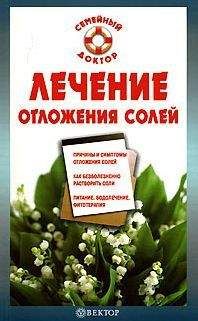 Ирина Калюжная - Лечение отложения солей - Читать 📖 Читать онлайн 👀 Читаемые книги читать онлайн бесплатно 🔥 booksread-online.com