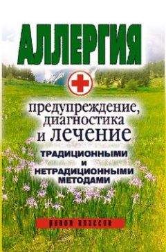 Ольга Сорокина - Аллергия. Предупреждение, диагностика и лечение традиционными и нетрадиционными методами - Читать | Читать онлайн | Читаемые книги читать онлайн бесплатно | booksread-online.com