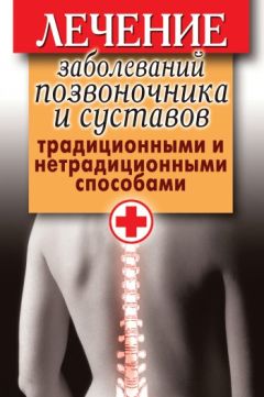 Дарья Нестерова - Лечение заболеваний позвоночника и суставов традиционными и нетрадиционными способами - Читать 📖 Читать онлайн 👀 Читаемые книги читать онлайн бесплатно 🔥 booksread-online.com