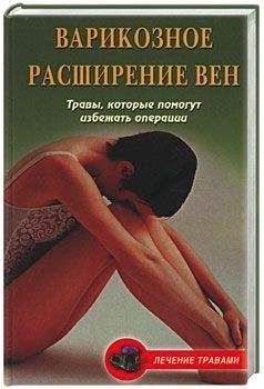 Вера Подколзина - Варикозное расширение вен. Травы, которые помогут избежать операции - Читать 📖 Читать онлайн 👀 Читаемые книги читать онлайн бесплатно 🔥 booksread-online.com
