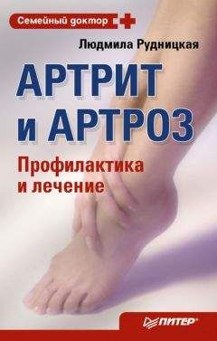 Людмила Рудницкая - Артрит и артроз. Профилактика и лечение - Читать 📖 Читать онлайн 👀 Читаемые книги читать онлайн бесплатно 🔥 booksread-online.com