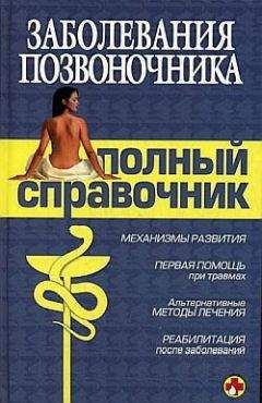 Коллектив Авторов - Заболевания позвоночника. Полный справочник - Читать 📖 Читать онлайн 👀 Читаемые книги читать онлайн бесплатно 🔥 booksread-online.com
