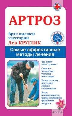 Лев Кругляк - Артроз. Самые эффективные методы лечения - Читать 📖 Читать онлайн 👀 Читаемые книги читать онлайн бесплатно 🔥 booksread-online.com