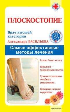 Александра Васильева - Плоскостопие. Самые эффективные методы лечения - Читать 📖 Читать онлайн 👀 Читаемые книги читать онлайн бесплатно 🔥 booksread-online.com