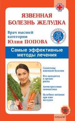 Юлия Попова - Язвенная болезнь желудка. Самые эффективные методы лечения - Читать 📖 Читать онлайн 👀 Читаемые книги читать онлайн бесплатно 🔥 booksread-online.com