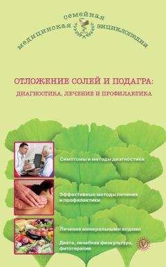 Ирина Малышева - Отложение солей и подагра. Лечение и профилактика - Читать | Читать онлайн | Читаемые книги читать онлайн бесплатно | booksread-online.com