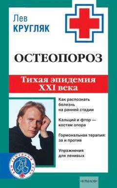 Лев Кругляк - Остеопороз. Тихая эпидемия XXI века - Читать 📖 Читать онлайн 👀 Читаемые книги читать онлайн бесплатно 🔥 booksread-online.com
