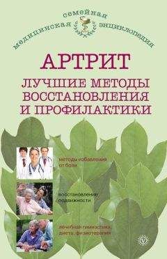 Ольга Родионова - Артрит. Лучшие методы восстановления и профилактики - Читать | Читать онлайн | Читаемые книги читать онлайн бесплатно | booksread-online.com