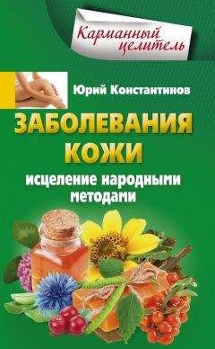 Юрий Константинов - Заболевания кожи. Исцеление народными методами - Читать 📖 Читать онлайн 👀 Читаемые книги читать онлайн бесплатно 🔥 booksread-online.com