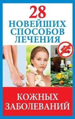 Полина Голицына - 28 новейших способов лечения кожных заболеваний - Читать 📖 Читать онлайн 👀 Читаемые книги читать онлайн бесплатно 🔥 booksread-online.com