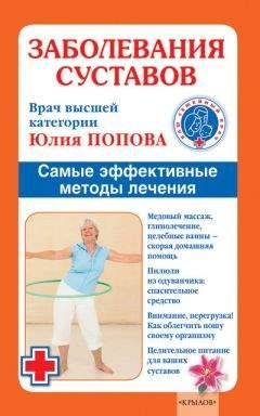 Юлия Попова - Заболевания суставов. Самые эффективные методы лечения - Читать 📖 Читать онлайн 👀 Читаемые книги читать онлайн бесплатно 🔥 booksread-online.com