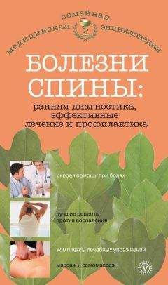 Ольга Родионова - Болезни спины: ранняя диагностика, эффективные лечение и профилактика - Читать | Читать онлайн | Читаемые книги читать онлайн бесплатно | booksread-online.com