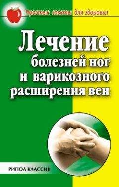 Евгения Сбитнева - Лечение болезней ног и варикозного расширения вен - Читать 📖 Читать онлайн 👀 Читаемые книги читать онлайн бесплатно 🔥 booksread-online.com