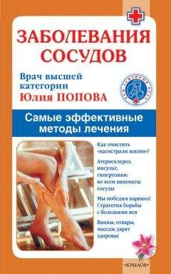 Юлия Попова - Заболевания сосудов. Самые эффективные методы лечения - Читать 📖 Читать онлайн 👀 Читаемые книги читать онлайн бесплатно 🔥 booksread-online.com
