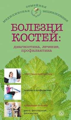Ольга Родионова - Болезни костей: диагностика, лечение, профилактика - Читать | Читать онлайн | Читаемые книги читать онлайн бесплатно | booksread-online.com