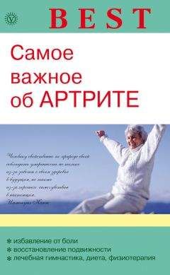 Ольга Родионова - Самое важное об артрите - Читать | Читать онлайн | Читаемые книги читать онлайн бесплатно | booksread-online.com