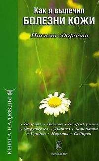 П. Аркадьев - Как я вылечил болезни кожи - Читать 📖 Читать онлайн 👀 Читаемые книги читать онлайн бесплатно 🔥 booksread-online.com
