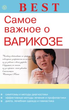 Ирина Малышева - Самое важное о варикозе - Читать 📖 Читать онлайн 👀 Читаемые книги читать онлайн бесплатно 🔥 booksread-online.com