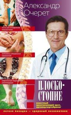 Александр Очерет - Плоскостопие. Легкая походка – здоровый позвоночник - Читать 📖 Читать онлайн 👀 Читаемые книги читать онлайн бесплатно 🔥 booksread-online.com