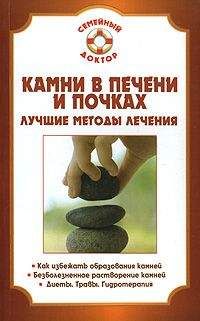Павел Мишинькин - Камни в почках и печени - Читать | Читать онлайн | Читаемые книги читать онлайн бесплатно | booksread-online.com