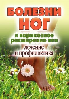 Дарья Нестерова - Болезни ног и варикозное расширение вен. Лечение и профилактика - Читать 📖 Читать онлайн 👀 Читаемые книги читать онлайн бесплатно 🔥 booksread-online.com