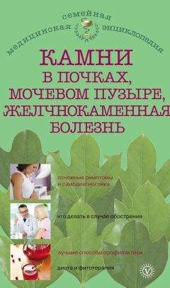 Александра Васильева - Камни в почках, мочевом пузыре, желчнокаменная болезнь - Читать 📖 Читать онлайн 👀 Читаемые книги читать онлайн бесплатно 🔥 booksread-online.com