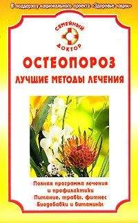 Ирина Калюжнова - Остеопороз - Читать 📖 Читать онлайн 👀 Читаемые книги читать онлайн бесплатно 🔥 booksread-online.com
