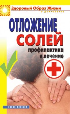Дарья Нестерова - Отложение солей. Профилактика и лечение - Читать 📖 Читать онлайн 👀 Читаемые книги читать онлайн бесплатно 🔥 booksread-online.com