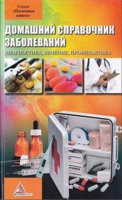 Я. Васильева (сост.) - Домашний справочник заболеваний - Читать 📖 Читать онлайн 👀 Читаемые книги читать онлайн бесплатно 🔥 booksread-online.com