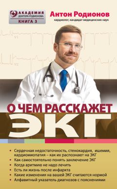 Антон Родионов - О чем расскажет ЭКГ - Читать 📖 Читать онлайн 👀 Читаемые книги читать онлайн бесплатно 🔥 booksread-online.com