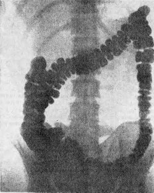 Личная гигиена йога - _28.jpg