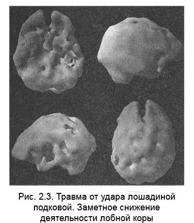 Измени мозг - изменится и тело - _13.jpg