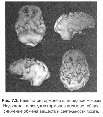 Измени мозг - изменится и тело - _25.jpg