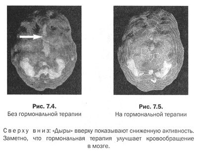 Измени мозг - изменится и тело - _27.jpg