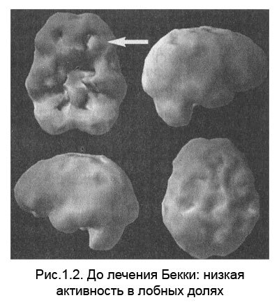 Измени мозг - изменится и тело - _3.jpg