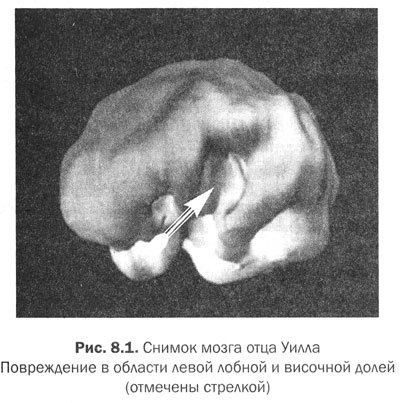 Измени мозг - изменится и тело - _33.jpg