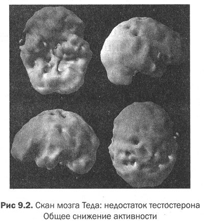 Измени мозг - изменится и тело - _36.jpg