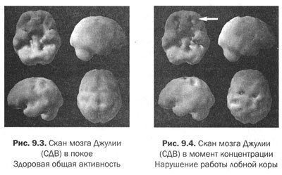 Измени мозг - изменится и тело - _37.jpg