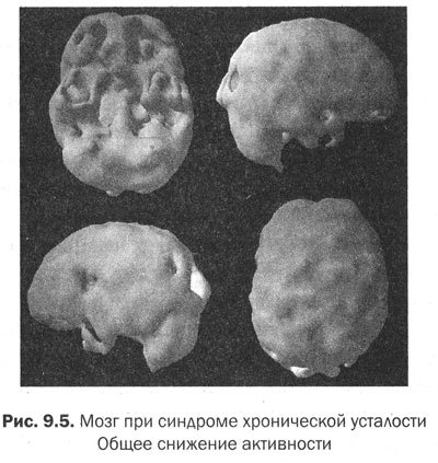 Измени мозг - изменится и тело - _38.jpg