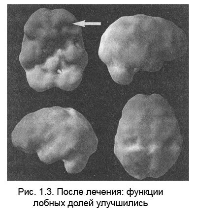 Измени мозг - изменится и тело - _4.jpg